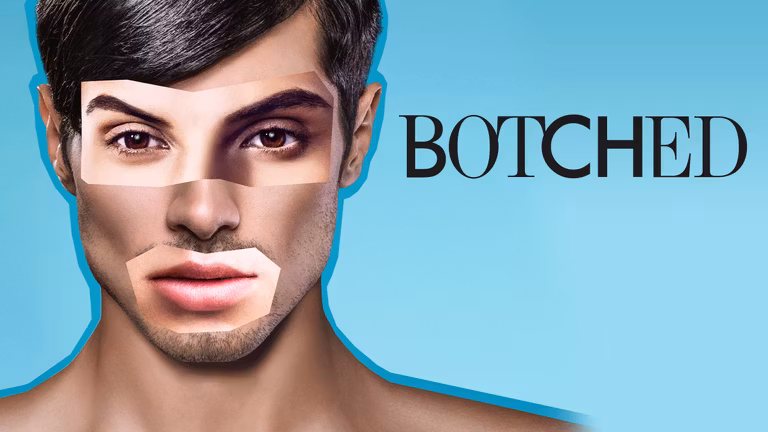 Botched