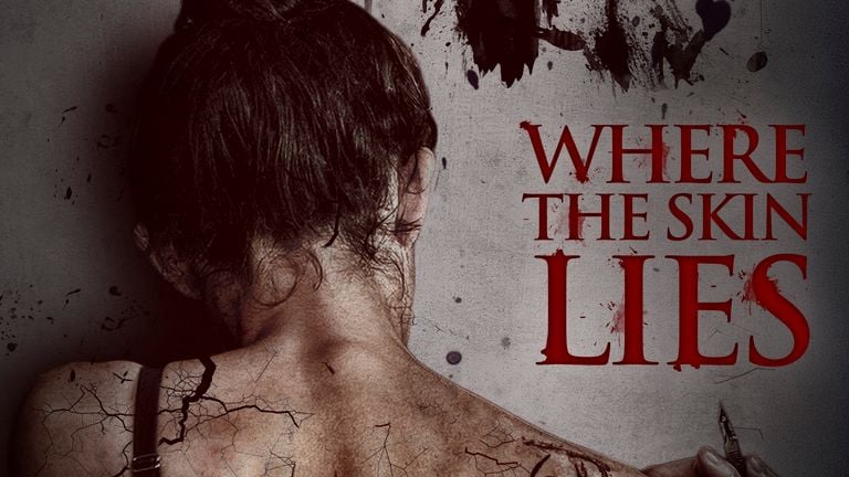 Where The Skin Lies